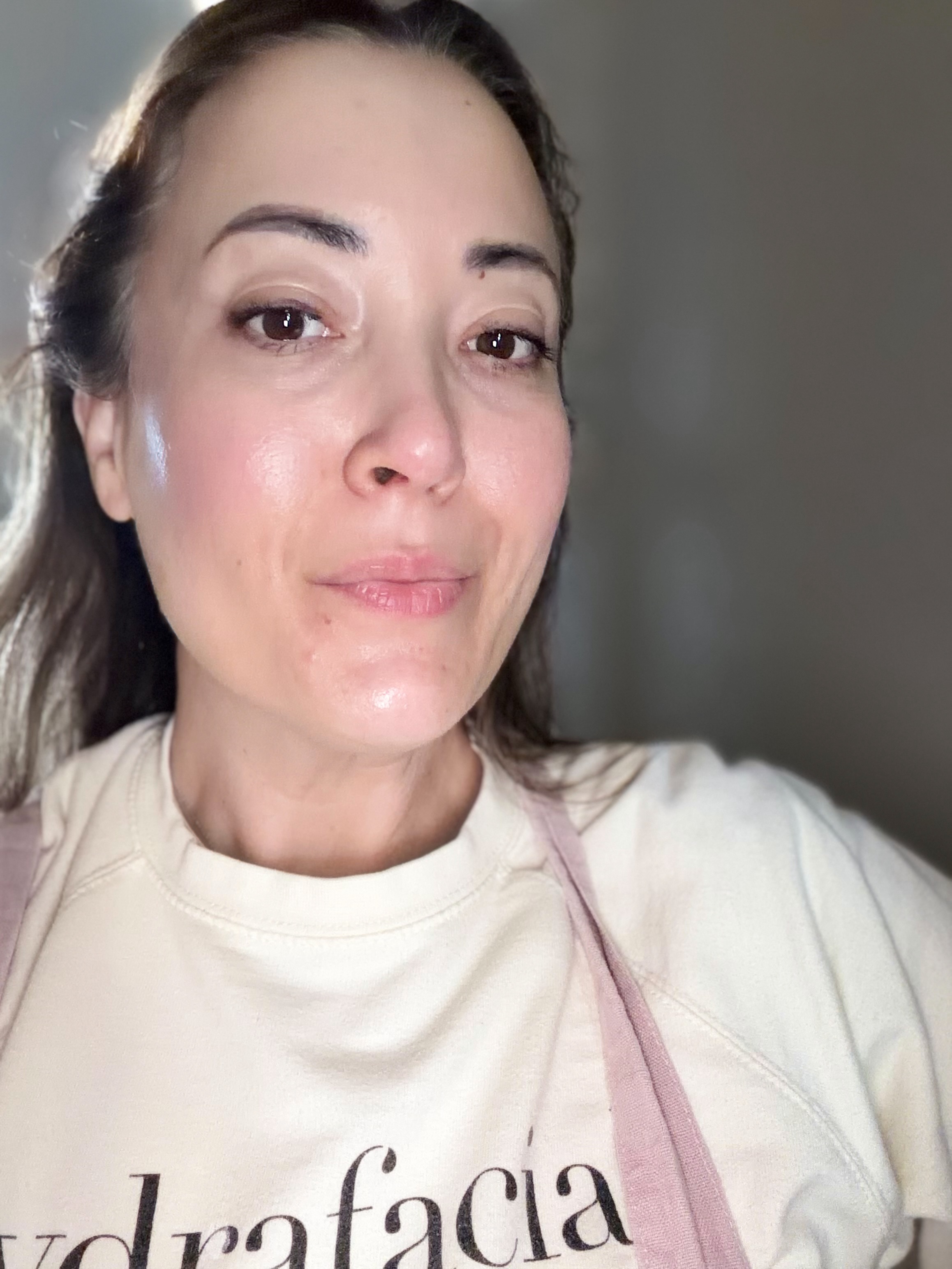 Perioral dermatitis is one of those skin conditions that can make you want to throw everything at your face. 

Unfortuna